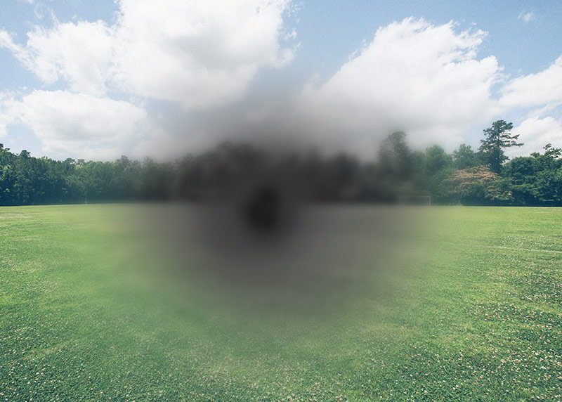 macular degeneration md south africa